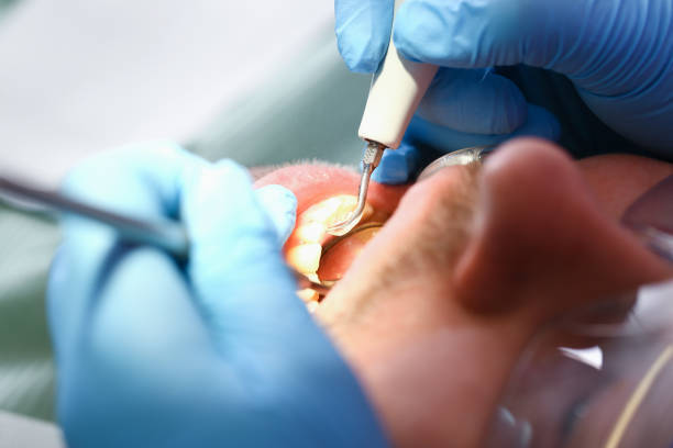 Best Mobile Emergency Dentist in Half Moon, NC