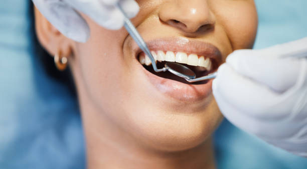 Best Emergency Dentist for Lost Fillings or Crowns in Half Moon, NC