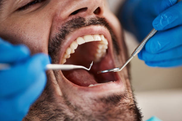 Best Broken or Cracked Tooth Emergency Dentist in Half Moon, NC