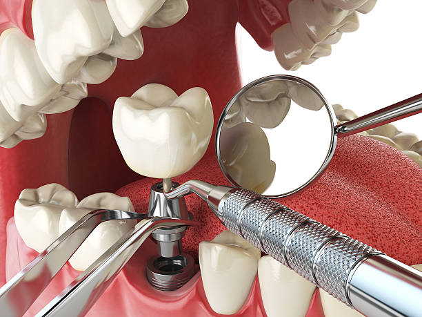 Best Holiday Emergency Dentist in Half Moon, NC