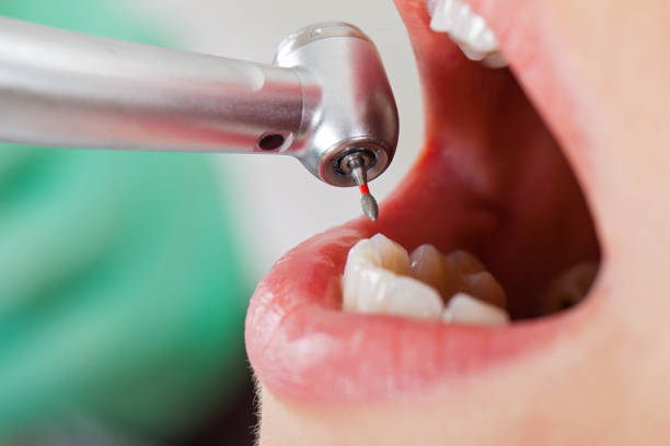 Best Emergency Dental Care for Abscessed Tooth in Half Moon, NC